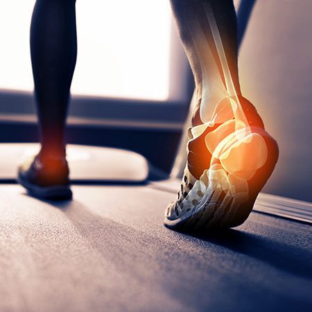 Physical Medicine Jacksonville FL Pain In Heel Physical Medicine Jacksonville FL Pain In Heel